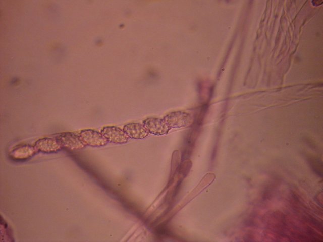 I Caratteri microscopici delle Pezizales