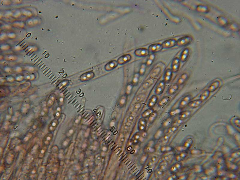 Morfologia delle spore