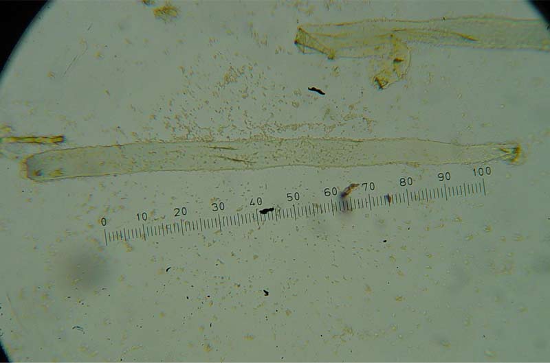 I Caratteri microscopici delle Pezizales