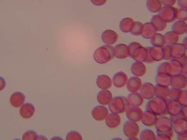 Da determinare (Laccaria sp.)