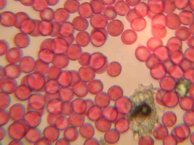 Da determinare (Laccaria sp.)