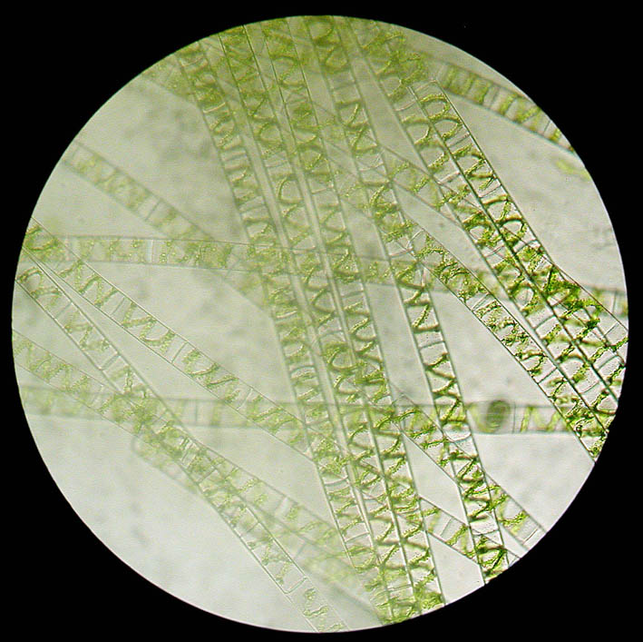 Spirogyra sp.