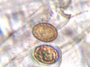 microscopio