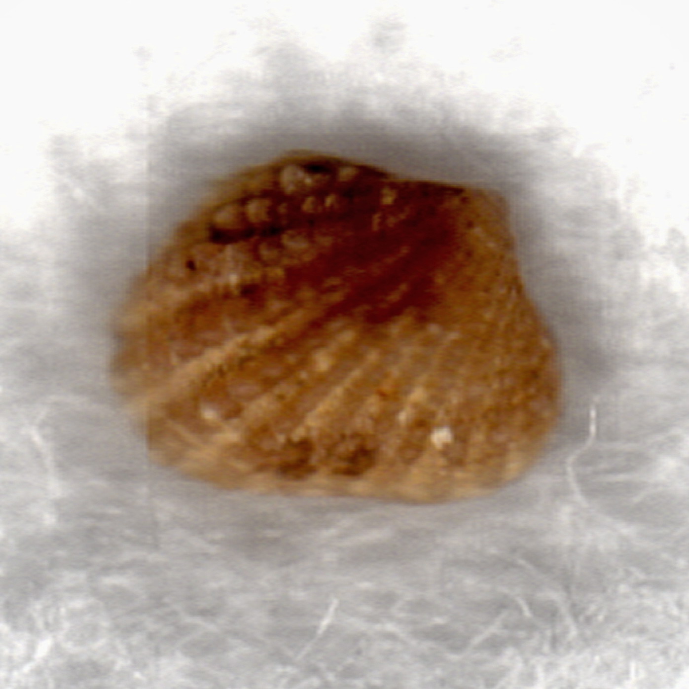 Cardita calyculata juv.