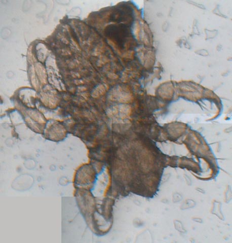 Ospite inatteso (ed indesiderato!): Pediculus humanus