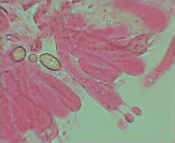 microscopio