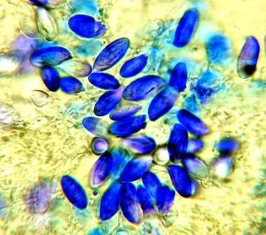 microscopio