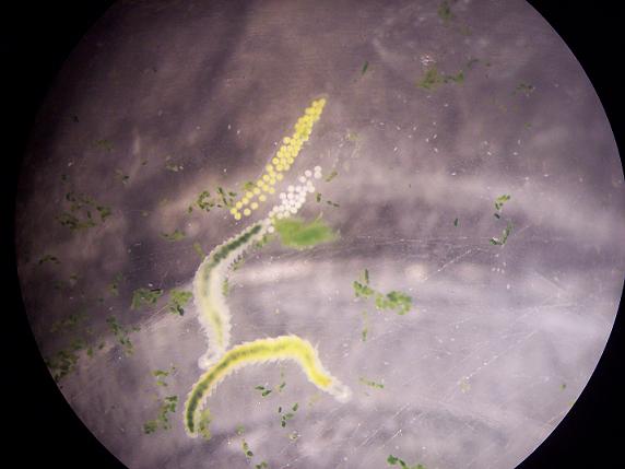 Ophryotrocha diadema