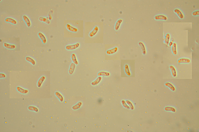 Postia caesia parassitizzata o con forma imperfetta?