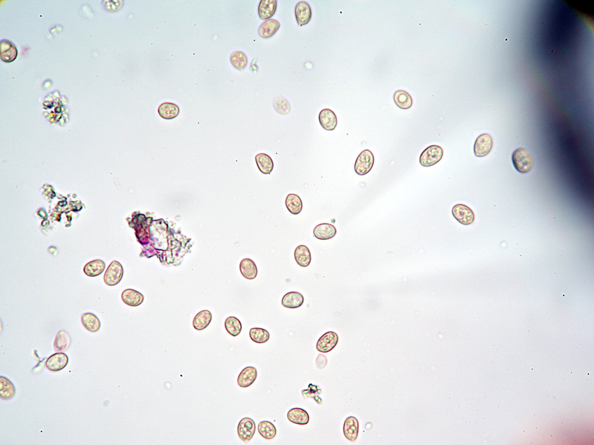 Fungo da determinare