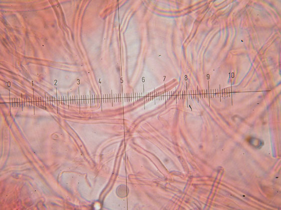 Schizopora flavipora (Berk. & M.A. Curtis ex Cooke) Ryvarden