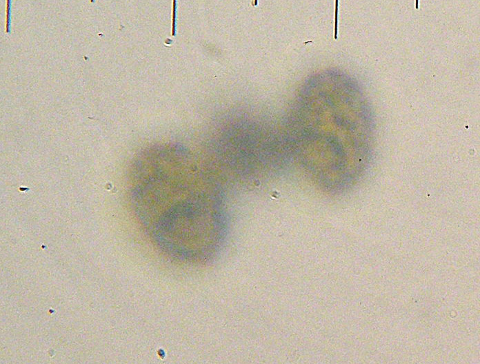 Melanoleuca da determinare