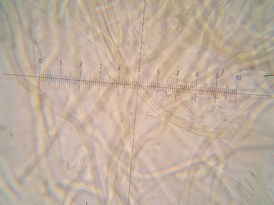Datronia mollis?