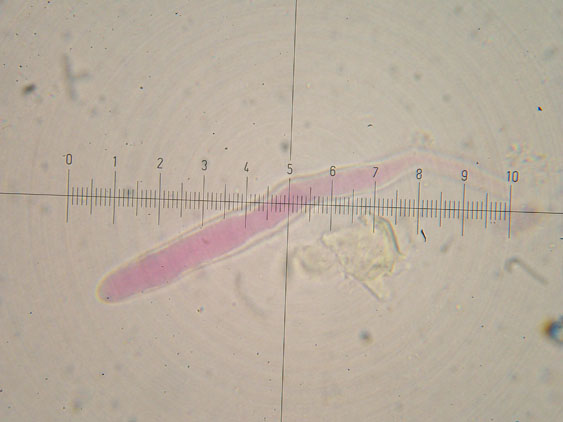 Da determinare (Phanerochaete leprosa)