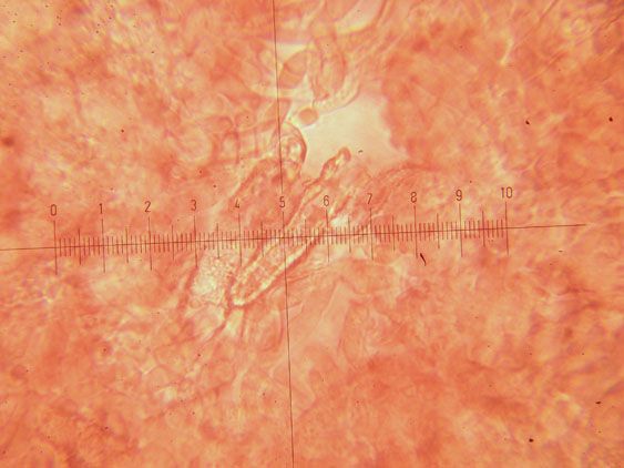 Da determinare (Phanerochaete leprosa)
