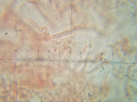 Schizopora flavipora (Berk. & M.A. Curtis ex Cooke) Ryvarden