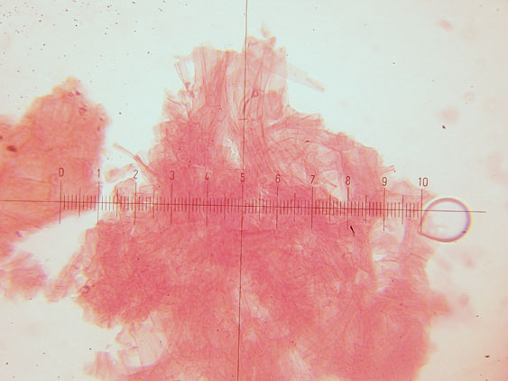 Melanoleuca da determinare