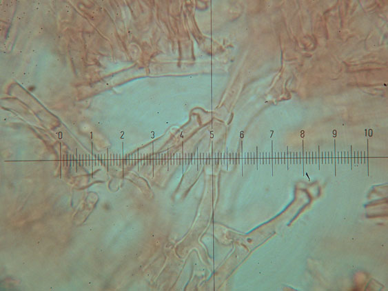 Hyphoderma setigerum (Fr.) Donk