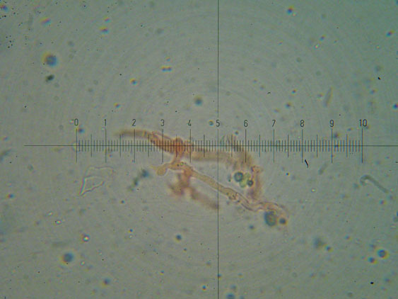 Peniophora lycii?