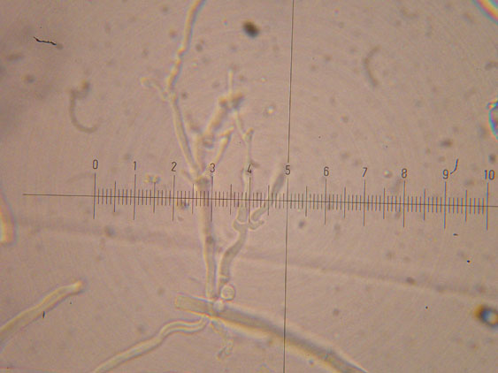 Da determinare (Datronia mollis)