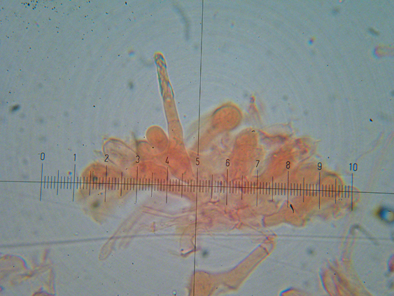 Melanoleuca da determinare