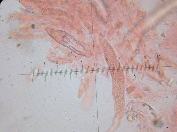 Peniophora lycii?