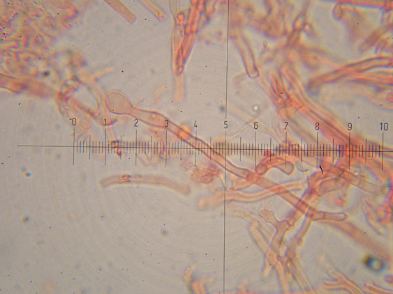 Schizopora flavipora (Berk. & M.A. Curtis ex Cooke) Ryvarden