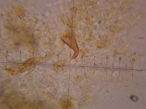 Inonotus da determinare - (Inonotus radiatus)