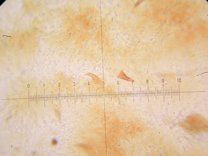 Inonotus da determinare - (Inonotus radiatus)