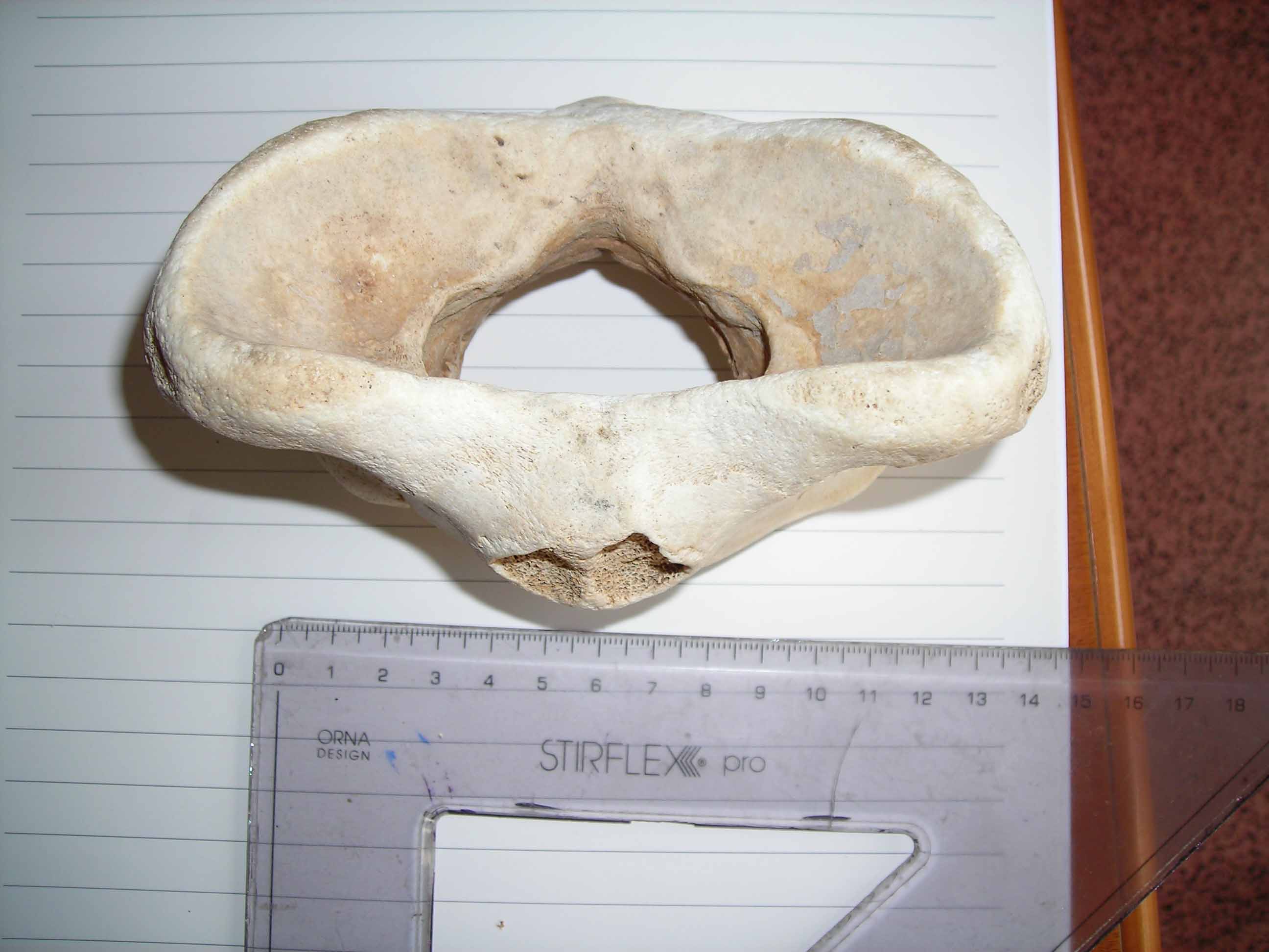 vertebra di?