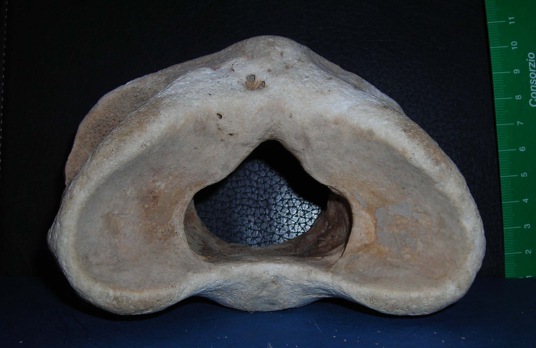 vertebra di?