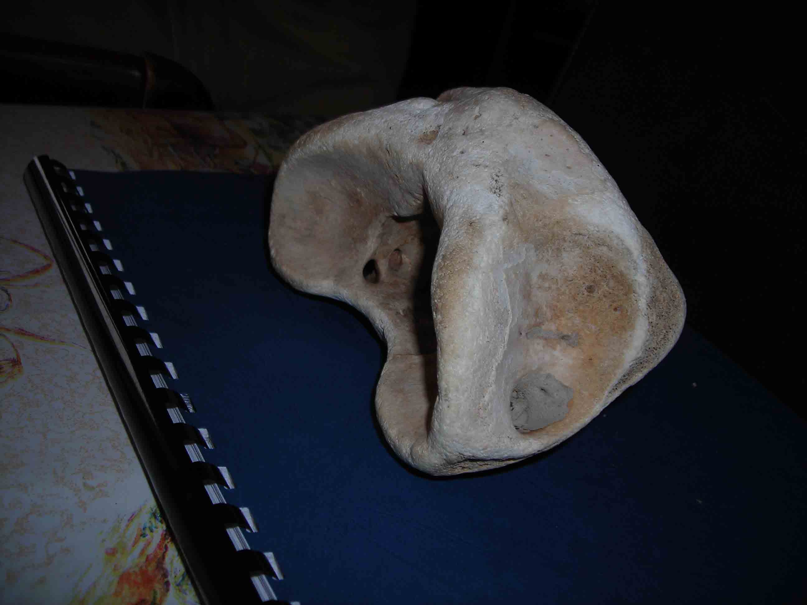 vertebra di?