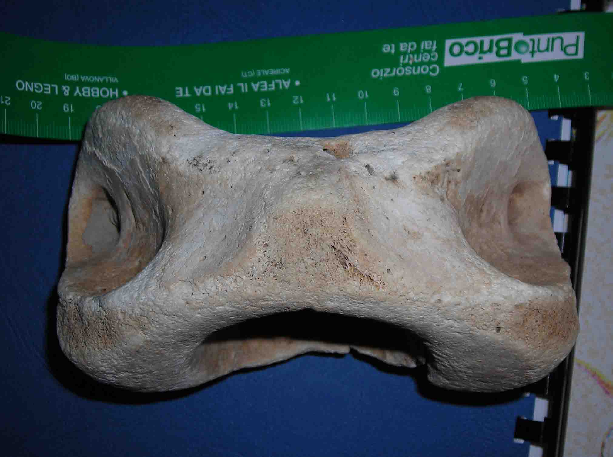 vertebra di?