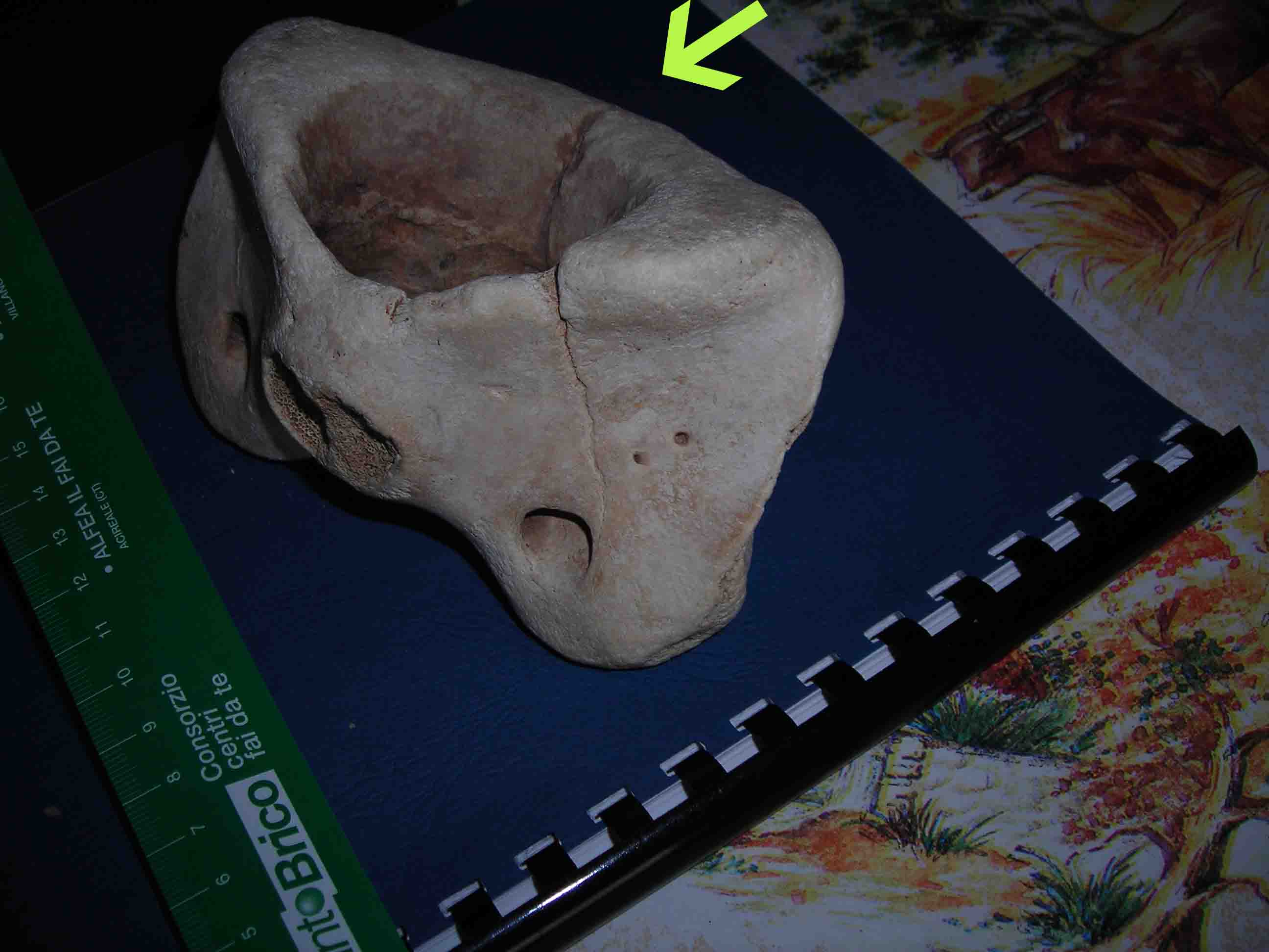 vertebra di?