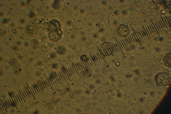 Un fungo da orto (Entoloma saundersii)