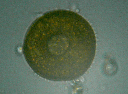 Microscopia delle acque astatiche del Bosco di Foglino