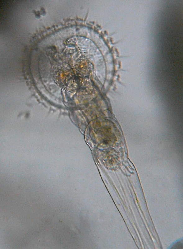 Microscopia delle acque astatiche del Bosco di Foglino