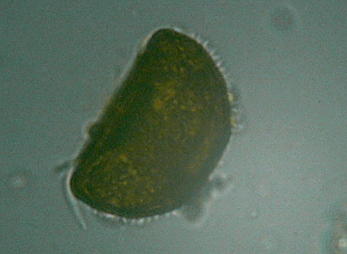 Microscopia delle acque astatiche del Bosco di Foglino