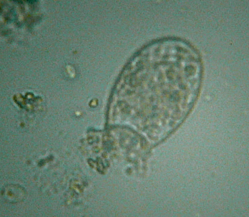 Microscopia delle acque astatiche del Bosco di Foglino
