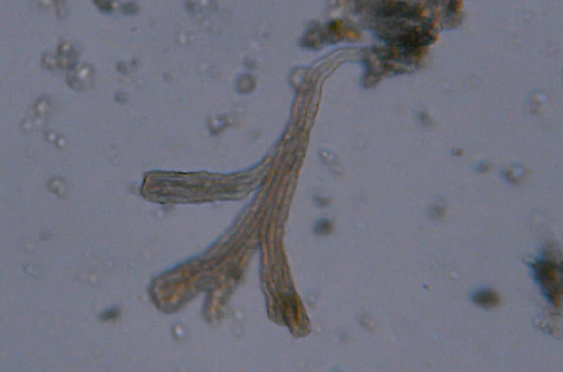 Microscopia delle acque astatiche del Bosco di Foglino