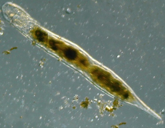 Microscopia delle acque astatiche del Bosco di Foglino