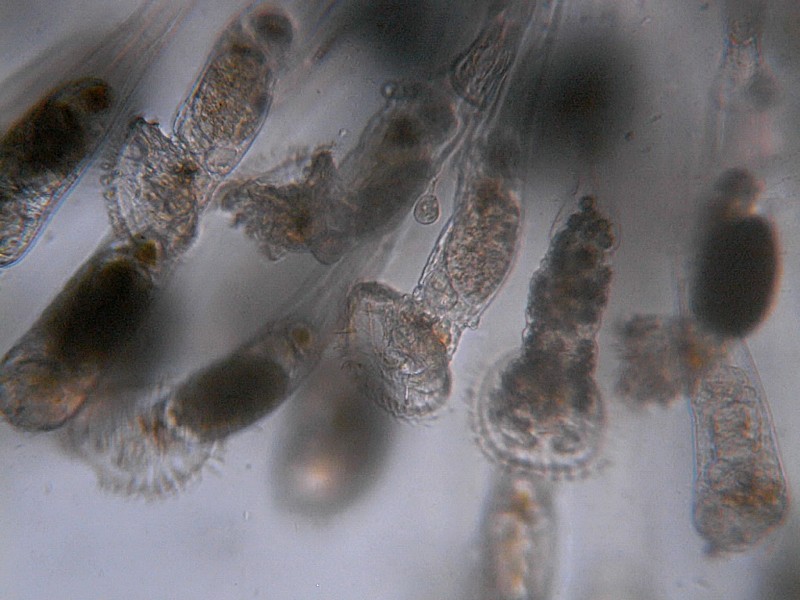 Microscopia delle acque astatiche del Bosco di Foglino