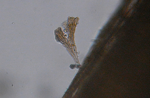 Microscopia delle acque astatiche del Bosco di Foglino