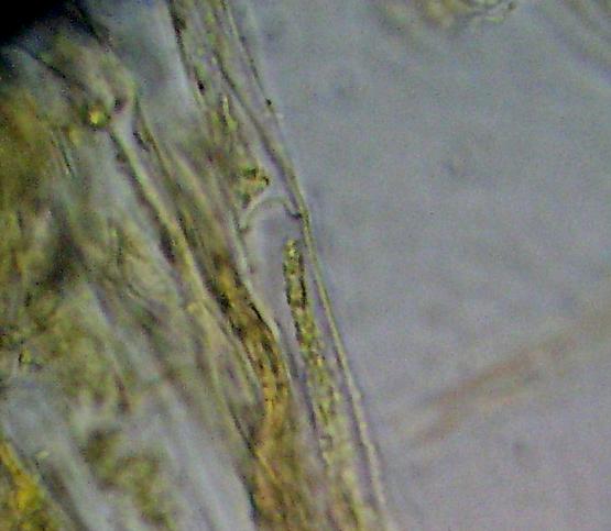 Macrolepiota sp. (cfr. Macrolepiota mastoidea)