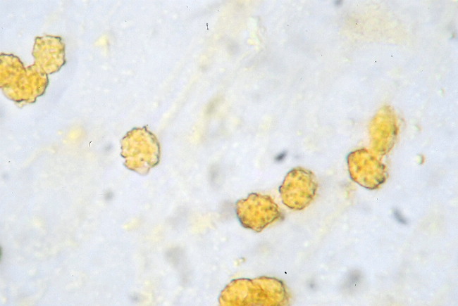 Presunta Tricholomella constricta