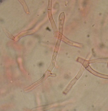 Alcuni ritrovamenti in lecceta