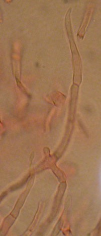 Alcuni ritrovamenti in lecceta