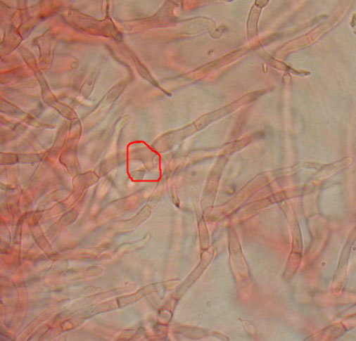 Alcuni ritrovamenti in lecceta