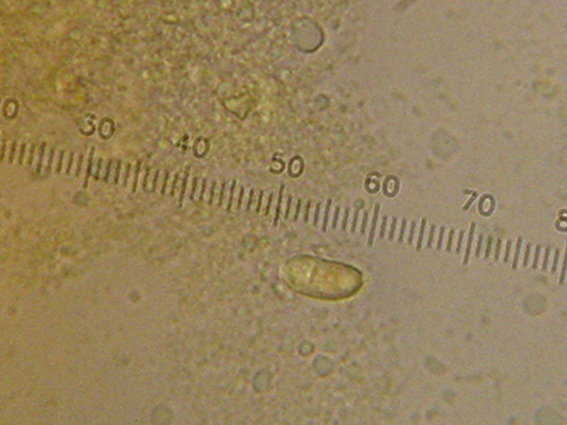 crosta porporacea