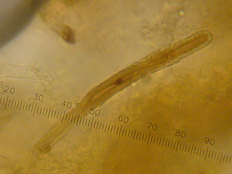 crosta porporacea
